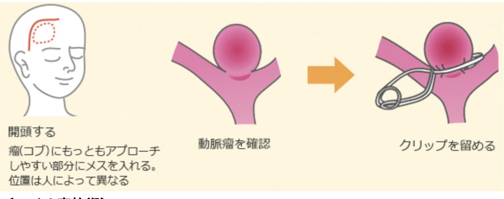 脳神経外科紹介原稿