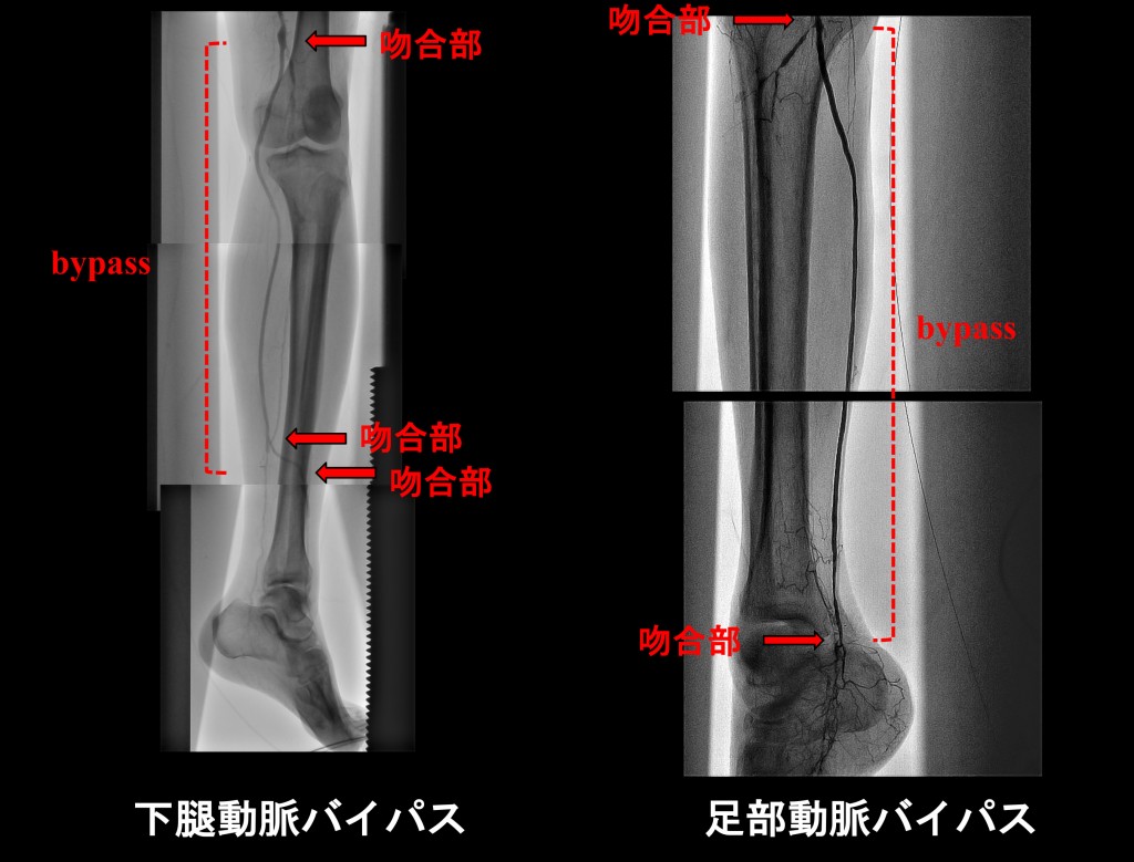 第5回　CLINCH