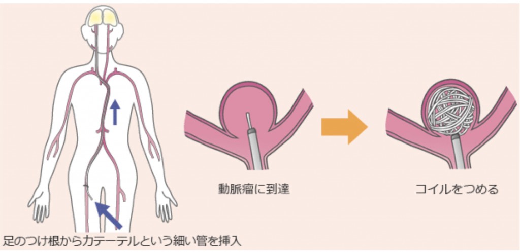 脳神経外科紹介原稿